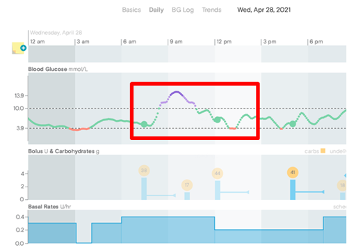 Tidepool - daily blood glucose graph with target range